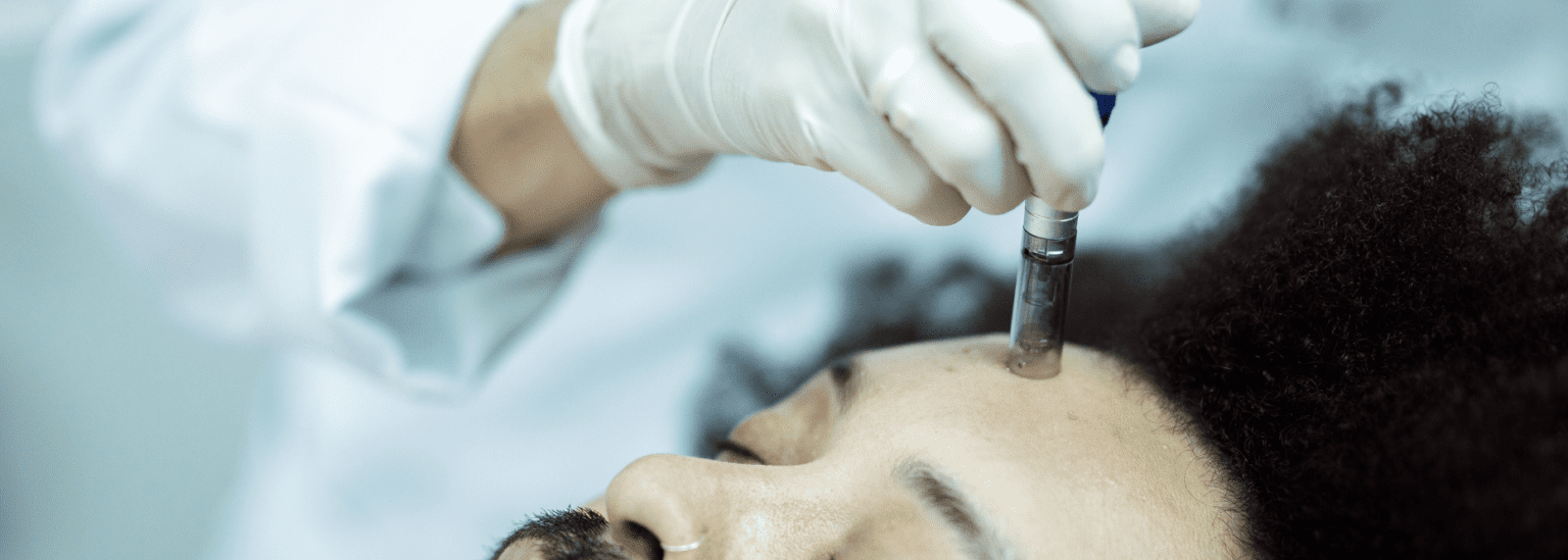 Mesotherapy Vs Microneedling: What Are The Differences?