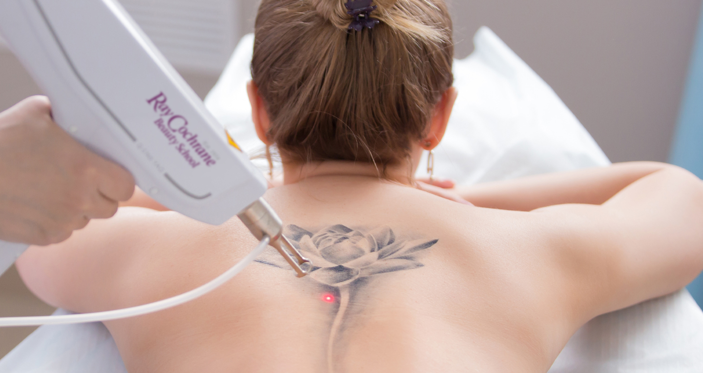 Laser Tattoo Removal  Technologie  MedicalAestheticSchoolcom