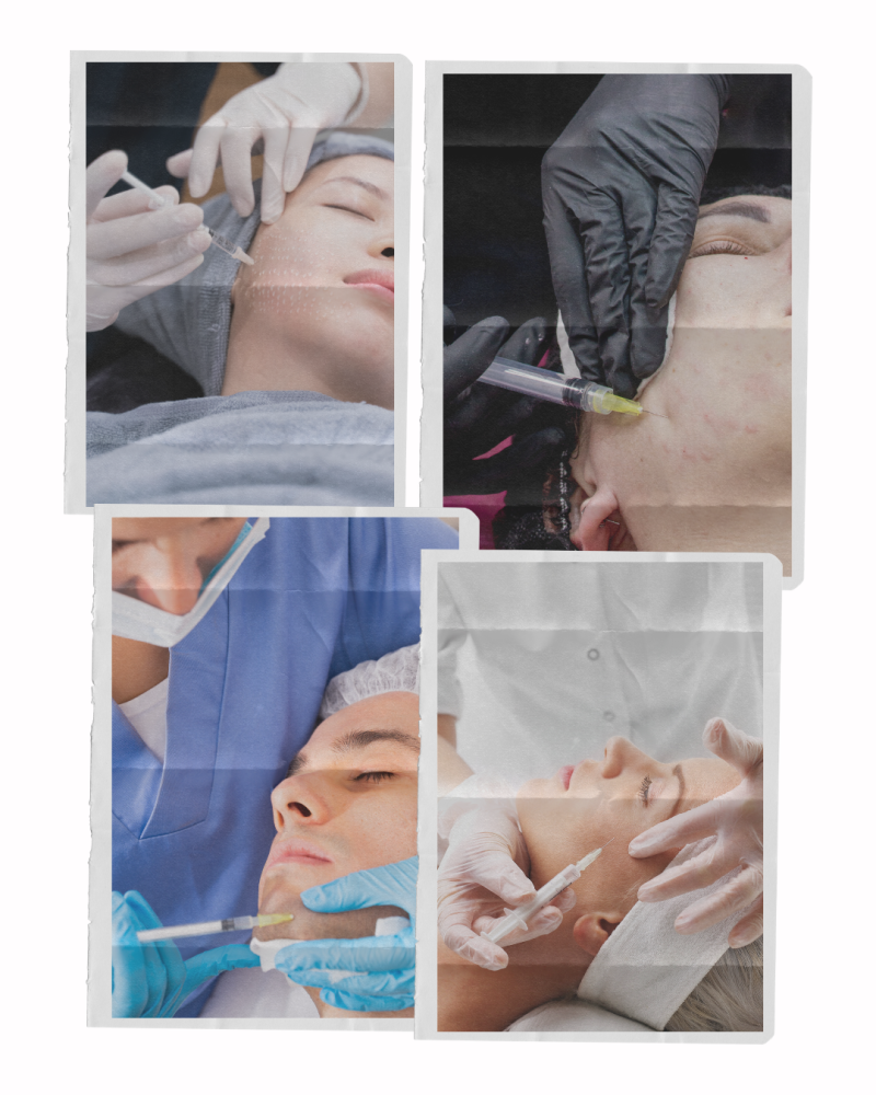 mesotherapy collage