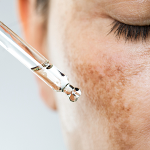 chemical peel vial for hyperpigmentation