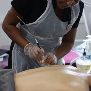 tutor demonstrating vacuum suction treatment on back - cupping treatment