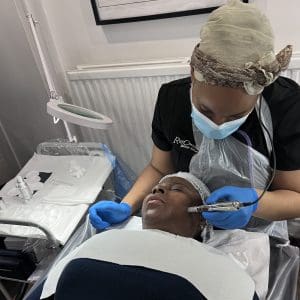 level 4 microneedling