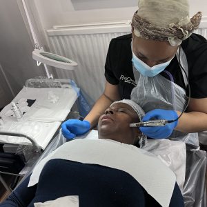 level 4 microneedling