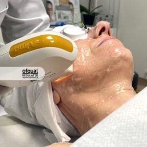 student performing laser hair removal and skin rejuvenation on face