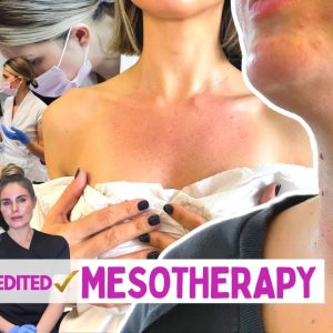 mesotherapy one day course